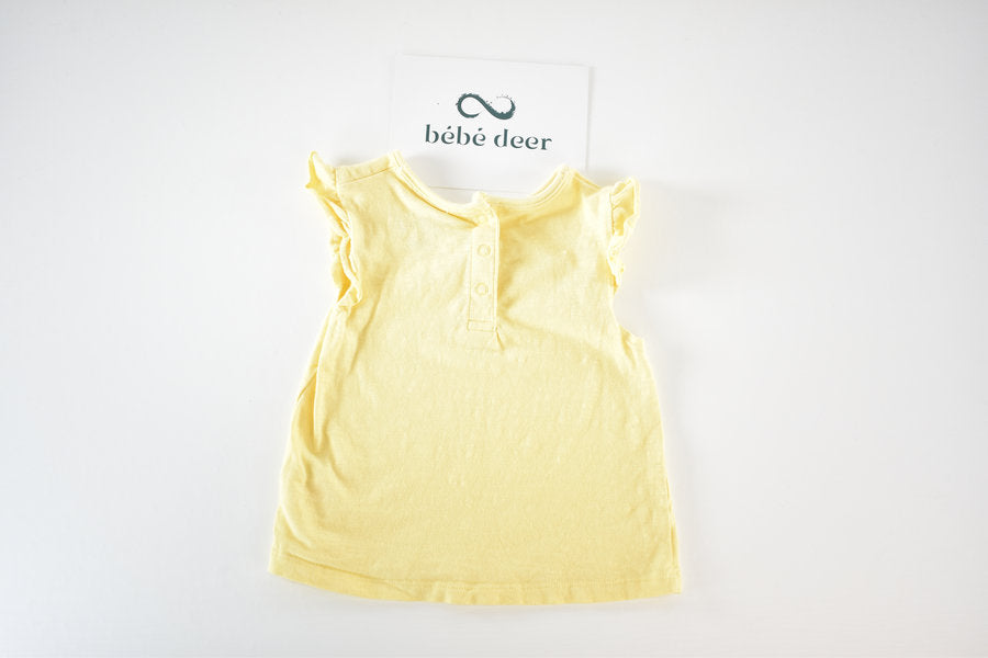 Yellow top with floral collar detail